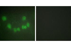 Peptide - +Western blot analysis of extracts from Jurkat cells, COLO205 cells and HUVEC, using CDC2 antibody. (CDK1 antibody  (Internal Region))
