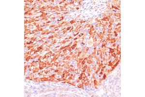 Immunohistochemistry of paraffin-embedded rat ovary using ASNS antibody (ABIN7265693) at dilution of 1:100 (40x lens). (Asparagine Synthetase antibody  (AA 262-561))