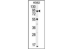 Western blot analysis of CCDC128 Antibody (Center) in K562 cell line lysates (35ug/lane). (KLRAQ1 antibody  (Middle Region))