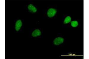 Immunofluorescence of purified MaxPab antibody to FLJ13798 on HeLa cell. (JMJD5 antibody  (AA 1-416))