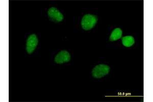 Immunofluorescence of purified MaxPab antibody to FLJ13798 on HeLa cell.