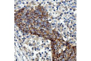 IHC analysis of EGFR using anti-EGFR antibody (ABIN7601478). (EGFR antibody  (AA 36-497))