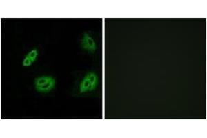 Immunofluorescence analysis of A549 cells, using OR4B1 Antibody.