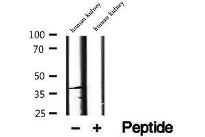 Western blot analysis of extracts of human kidney tissue, using DYNC2LI1 antibody. (DYNC2LI1 antibody  (Internal Region))