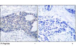 Image no. 1 for anti-zeta-Chain (TCR) Associated Protein Kinase 70kDa (ZAP70) (pTyr493) antibody (ABIN196887) (ZAP70 antibody  (pTyr493))