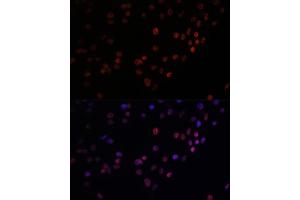 Immunofluorescence analysis of C6 cells using Matrin 3 antibody (ABIN7268415) at dilution of 1:100. (MATR3 antibody  (AA 747-847))