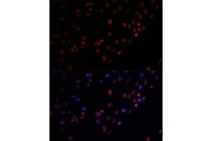 Immunofluorescence analysis of C6 cells using Matrin 3 antibody (ABIN7268415) at dilution of 1:100.