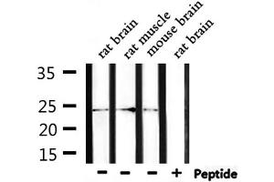 Western blot analysis of extracts from rat brain, rat muscle, mouse brain, using ZNRF1 Antibody.