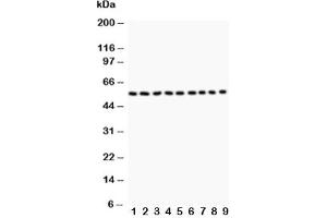 Western blot testing of Desmin antibody and Lane 1:  (rat) skeletal muscle;  2: (r) heart;  3: (mouse) skeletal muscle;  4: (m) heart;  5: (h) HeLa;  6: (h) HT1080;  7: (h) COLO320;  8: (h) HEPA;  9: (m) NIH3T3