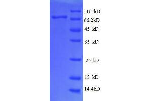 SDS-PAGE (SDS) image for Dolichyl-diphosphooligosaccharide--Protein Glycosyltransferase (DDOST) (AA 44-427), (partial) protein (GST tag) (ABIN1046934) (DDOST Protein (AA 44-427, partial) (GST tag))