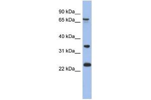 WB Suggested Anti-TBC1D25 Antibody Titration: 0.