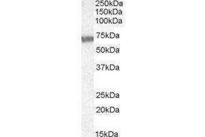 ABIN2560879 (0. (ABCD4 antibody  (Internal Region))