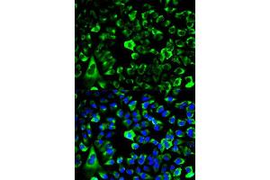 Immunofluorescence analysis of HeLa cell using RPS3 antibody.