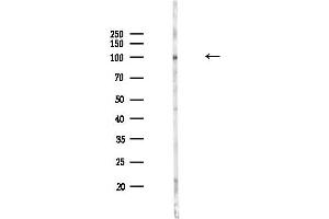 Western blot analysis of lysates from Mouse lung, using Phospho-alpha 1 Catenin (Ser655/Thr658) Antibody at 1/1000 dilution.