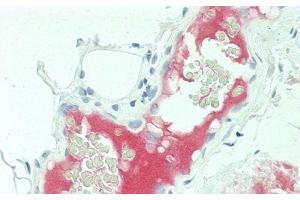 Immunohistochemistry (IHC) image for anti-Complement Component 5a (C5a) (AA 678-751) antibody (ABIN7427906)