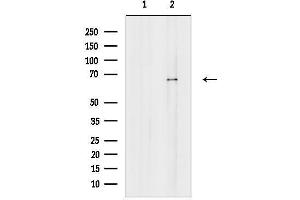 anti-Zinc Finger Protein 416 (ZNF416) antibody