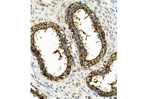 IHC analysis of Hexokinase 1/HK1 using anti-Hexokinase 1/HK1 antibody (ABIN7600259). (Hexokinase 1 antibody  (AA 17-323))