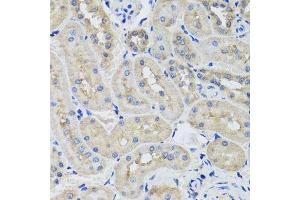 Immunohistochemistry of paraffin-embedded rat kidney using STK3 antibody. (STK3 antibody  (AA 323-450))