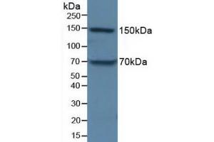 Figure. (APOB antibody  (AA 3365-3548))