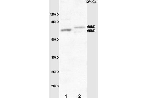 FZD10 antibody  (AA 101-200)