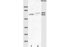 L1 mouse embryo lysate L2 human colon carcinoma lysates probed with Rabbit Anti-Frizzled 10/CD350 Polyclonal Antibody, Unconjugated  at 1:3000 for 90 min at 37˚C. (FZD10 antibody  (AA 101-200))