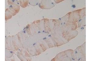 Detection of PLA2R1 in Mouse Skeletal muscle Tissue using Polyclonal Antibody to Phospholipase A2 Receptor 1 (PLA2R1) (PLA2R1 antibody  (AA 1418-1487))