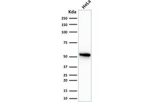 Western Blot Analysis of human HeLa cell lysate using Cytokeratin 7 Mouse Monoclonal Antibody (OV-TL12/30).