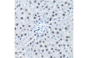 Immunohistochemistry (IHC) image for anti-Small Nuclear Ribonucleoprotein Polypeptide A (SNRPA) (AA 1-220) antibody (ABIN6148212)