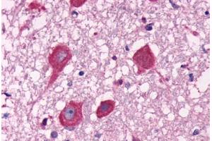 Anti-GPR40 antibody  ABIN1048820 IHC staining of human brain, neurons. (FFAR1 antibody  (C-Term))