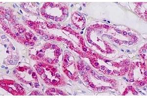 Human Kidney: Formalin-Fixed, Paraffin-Embedded (FFPE) (PLAGL1 antibody  (AA 311-360))