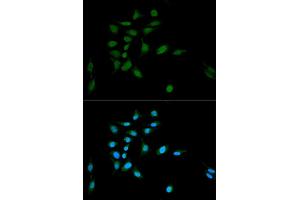 Immunofluorescence analysis of U2OS cells using PSMA1 antibody (ABIN5971354) at dilution of 1/100.