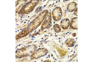 Immunohistochemistry of paraffin-embedded human colon using CAPNS1 antibody. (Calpain S1 antibody  (AA 69-268))