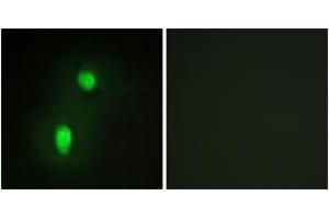 Immunofluorescence analysis of HuvEc cells, using hnRNP C1/C2 Antibody. (HNRNPC antibody  (AA 241-290))