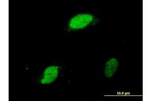 Immunofluorescence of monoclonal antibody to EGR1 on HeLa cell. (EGR1 antibody  (AA 444-543))