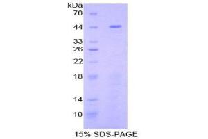 SDS-PAGE (SDS) image for Fibulin 1 (FBLN1) (AA 127-243) protein (His tag,GST tag) (ABIN2122861)