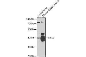 Western blot analysis of extracts of various cell lines, using MEK3 antibody (ABIN6130544, ABIN6143484, ABIN6143485 and ABIN6223650) at 1:1000 dilution. (MAP2K3 antibody  (AA 1-170))