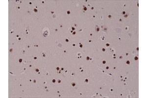 IHC testing of FFPE human brain with recombinant 5hmC antibody. (Recombinant 5-Hydroxymethylcytosine antibody)