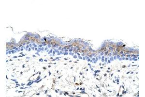 IRX3 antibody was used for immunohistochemistry at a concentration of 4-8 ug/ml to stain Squamous epithelial cells (arrows) in Human Skin.