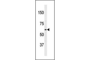 Western blot analysis of anti-T1(PBP2) Antibody (Center) 7274c in HL60 cell line lysates (35 μg/lane).