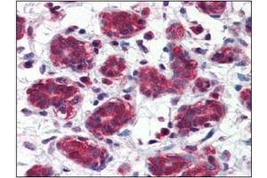 Immunohistochemistry (IHC) image for anti-Folate Hydrolase (Prostate-Specific Membrane Antigen) 1 (FOLH1) (AA 117-351) antibody (ABIN317554) (PSMA antibody  (AA 117-351))