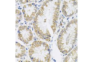 Immunohistochemistry of paraffin-embedded human stomach using IL13 antibody (ABIN3022881, ABIN3022882, ABIN3022883 and ABIN6219278) (40x lens). (IL-13 antibody  (AA 25-146))