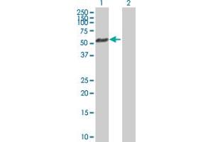 Western Blot analysis of AKT1 expression in transfected 293T cell line by AKT1 MaxPab polyclonal antibody. (AKT1 antibody  (AA 1-480))