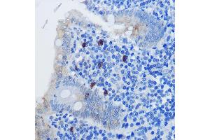 Immunohistochemistry of paraffin-embedded human appendix using IL8 Rabbit pAb (ABIN3016225, ABIN3016226, ABIN3016227 and ABIN6219634) at dilution of 1:100 (40x lens). (IL-8 antibody  (AA 21-99))