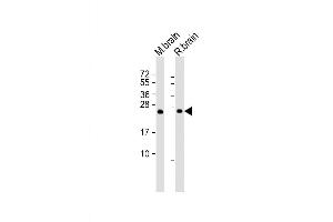 Lane 1: mouse brain lysates, Lane 2: rat brain lysates, probed with RAB3A (1531CT562. (RAB3A antibody)