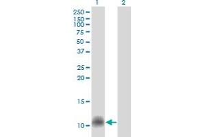 Western Blot analysis of CCL14 expression in transfected 293T cell line by CCL14 monoclonal antibody (M01), clone 1F12.