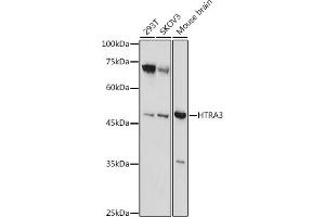 Western blot analysis of extracts of various cell lines, using HTR antibody (ABIN7267790) at 1:1000 dilution. (HTRA3 antibody  (AA 334-453))
