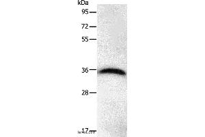 Western blot analysis of Hela cell, using PPP1CB Polyclonal Antibody at dilution of 1:450 (PPP1CB antibody)