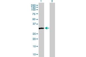 Western Blot analysis of CAPZA3 expression in transfected 293T cell line by CAPZA3 MaxPab polyclonal antibody.