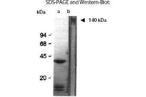 Western Blotting (WB) image for anti-Aggregation Factor antibody (ABIN191910) (Aggregation Factor antibody)