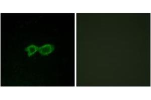 Immunofluorescence analysis of LOVO cells, using OR13C4 Antibody.